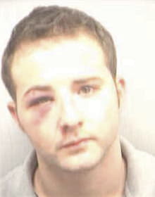 Yohance Skeete - Fulton County, GA 